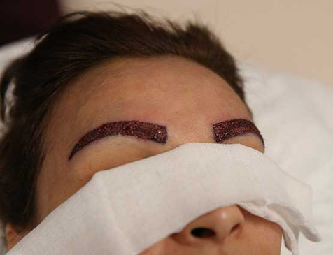 Slider image (7) Biruni Hair Institute